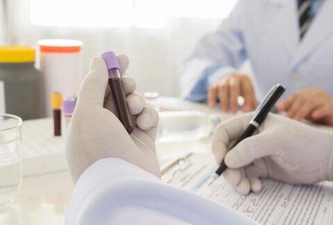Private Blood Tests