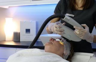 IPL Skin Treatments
